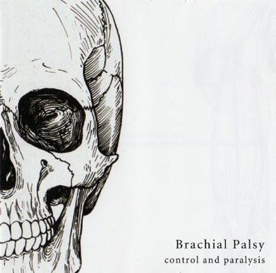 BRACHIAL PALSY : Control And Paralysis - ウインドウを閉じる