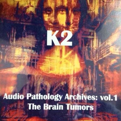 K2 : The Brain Tumors