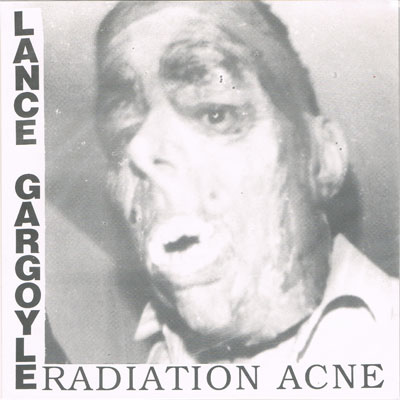 LANCE GARGOYLE : Radiation Acne
